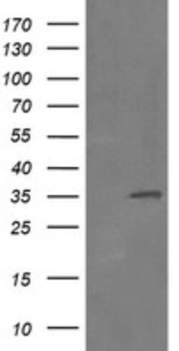 Western Blot: RFC2 Antibody (2B2) [NBP2-45570] - Analysis of HEK293T cells were transfected with the pCMV6-ENTRY control (Left lane) or pCMV6-ENTRY RFC2.