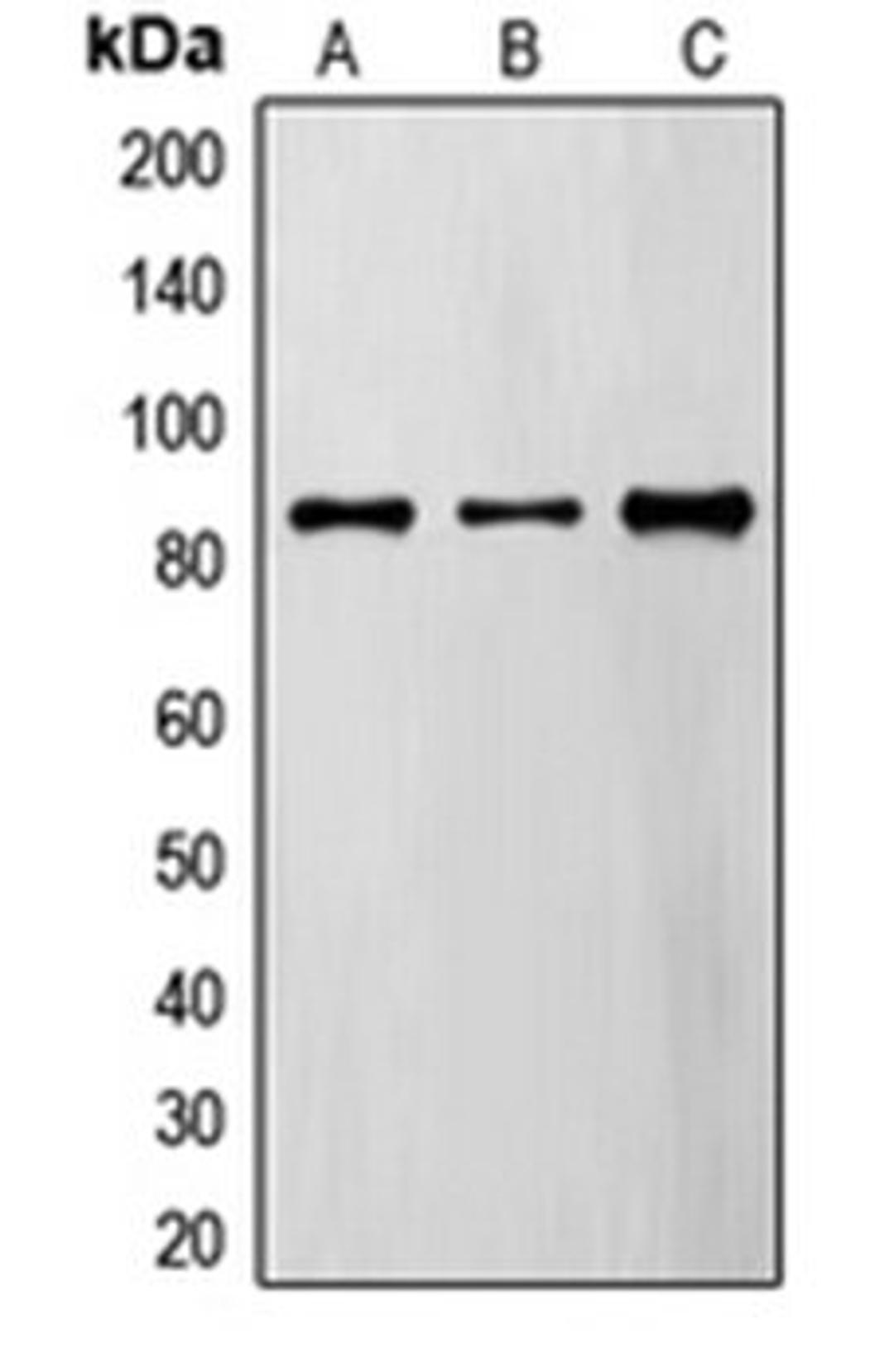 Western blot analysis of A549 (Lane 1), MDAMB435 (Lane 2), TF1 (Lane 3) whole cell lysates using FYB antibody