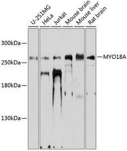 Western blot - MYO18A antibody (A9015)