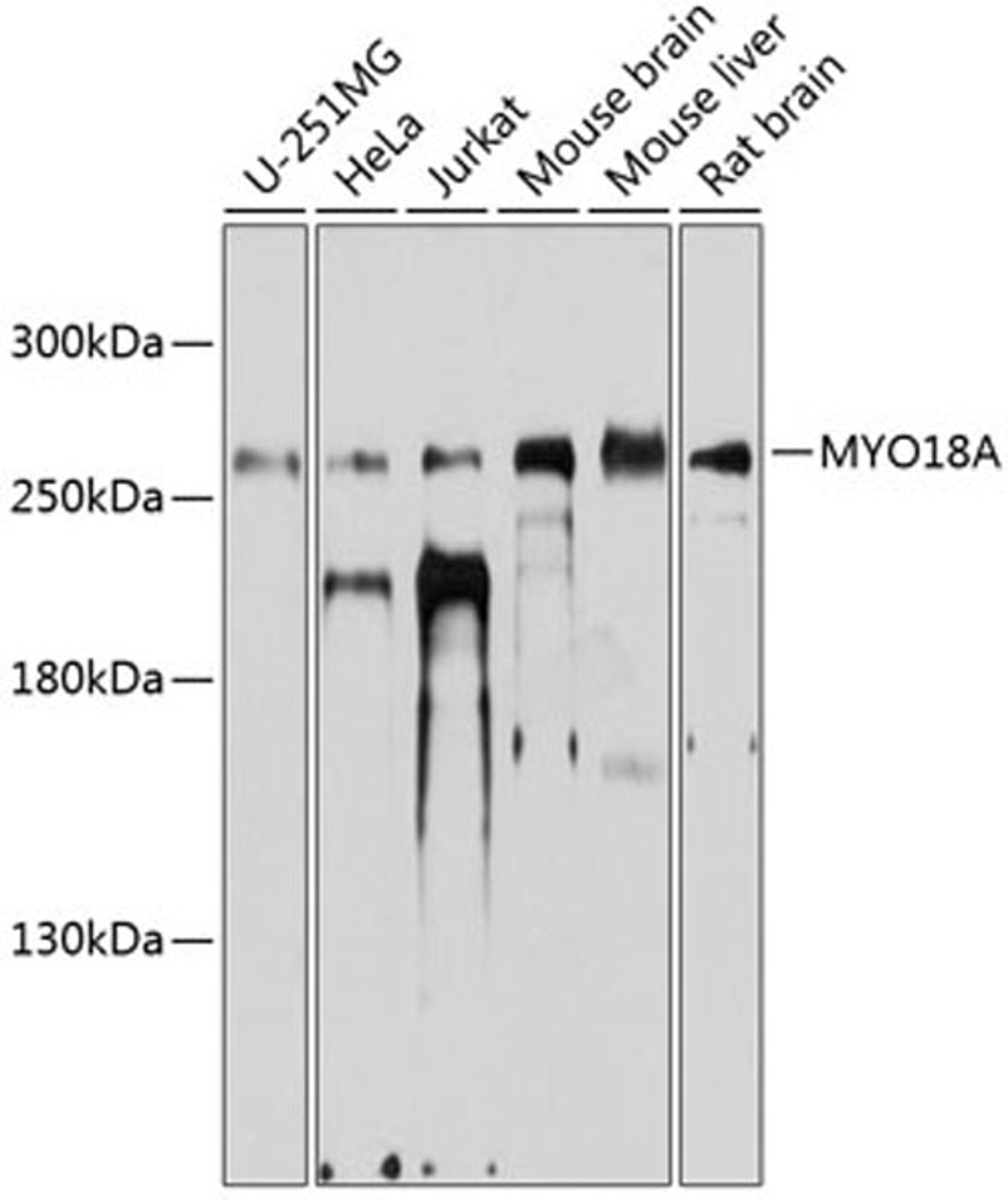 Western blot - MYO18A antibody (A9015)