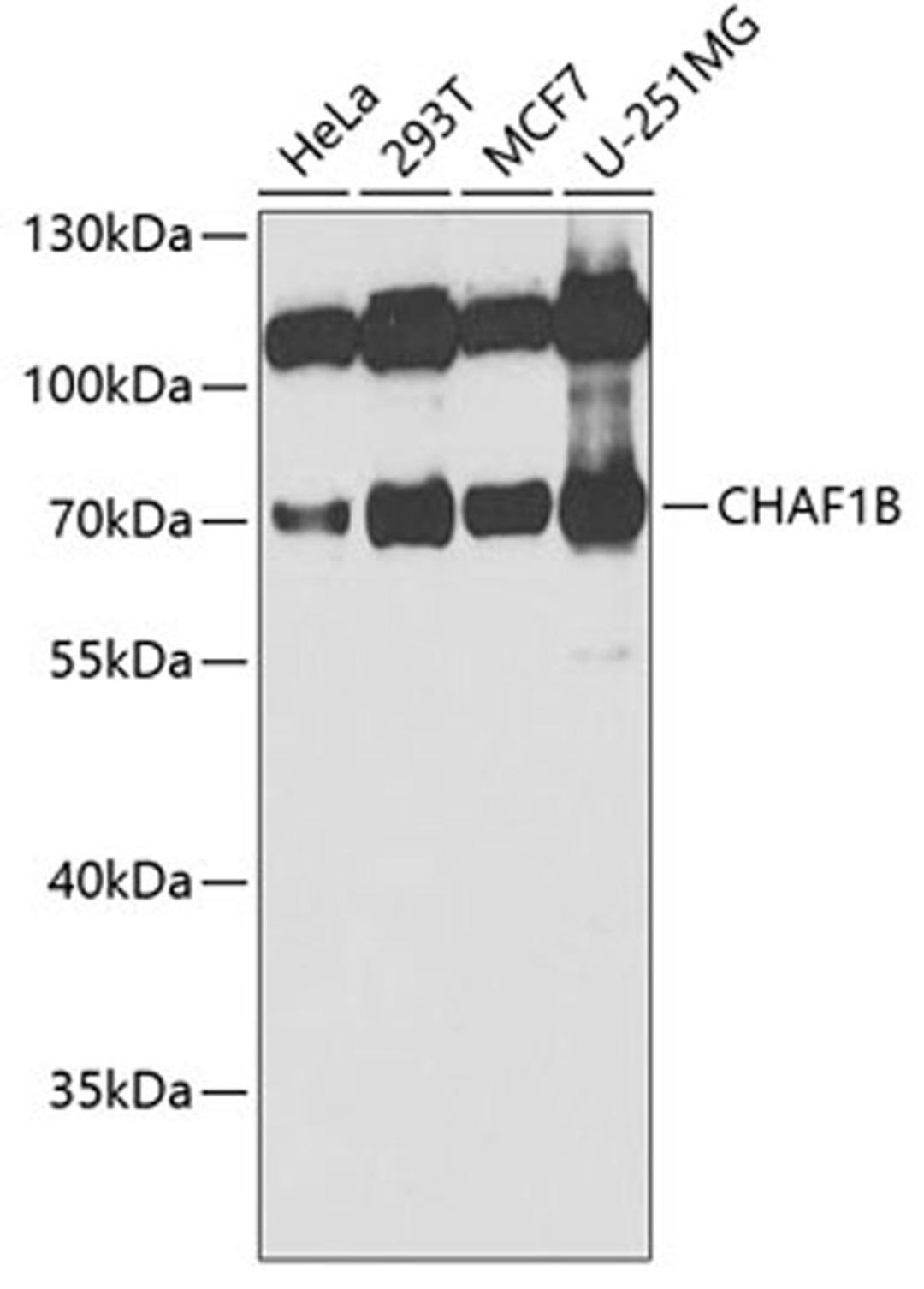 Western blot - CHAF1B antibody (A6259)