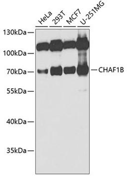 Western blot - CHAF1B antibody (A6259)