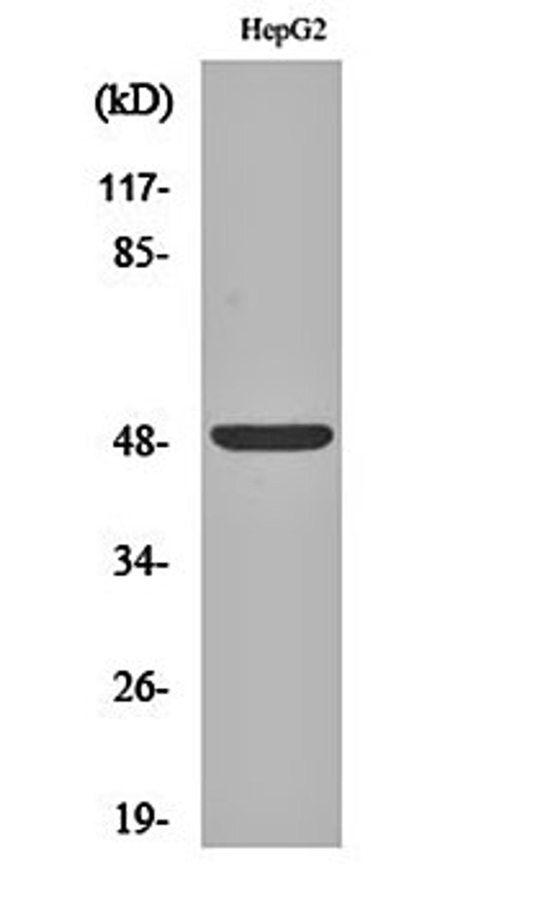 Western blot analysis of HepG2 cell lysates using ETAR antibody