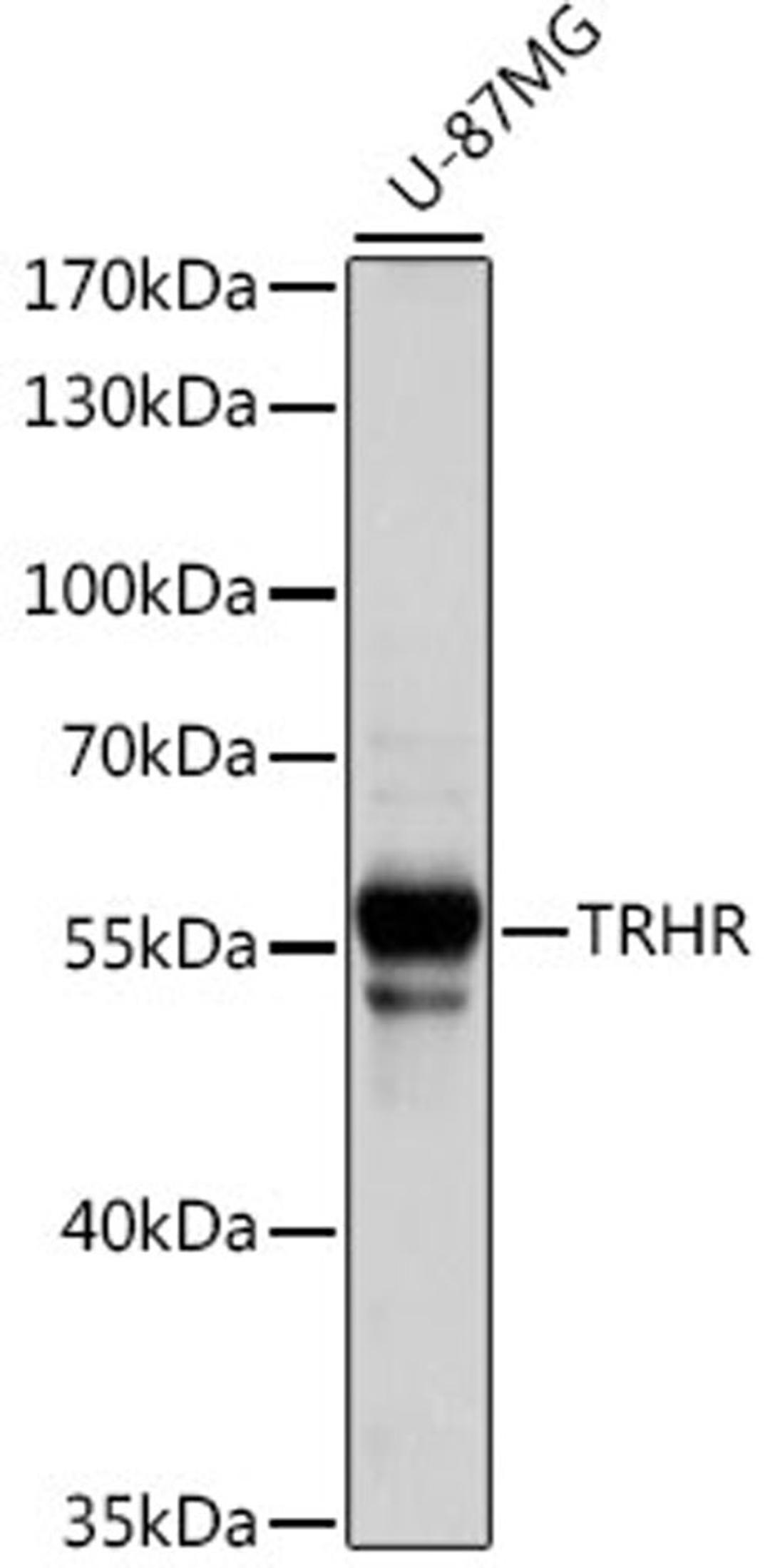 Western blot - TRHR antibody (A15235)