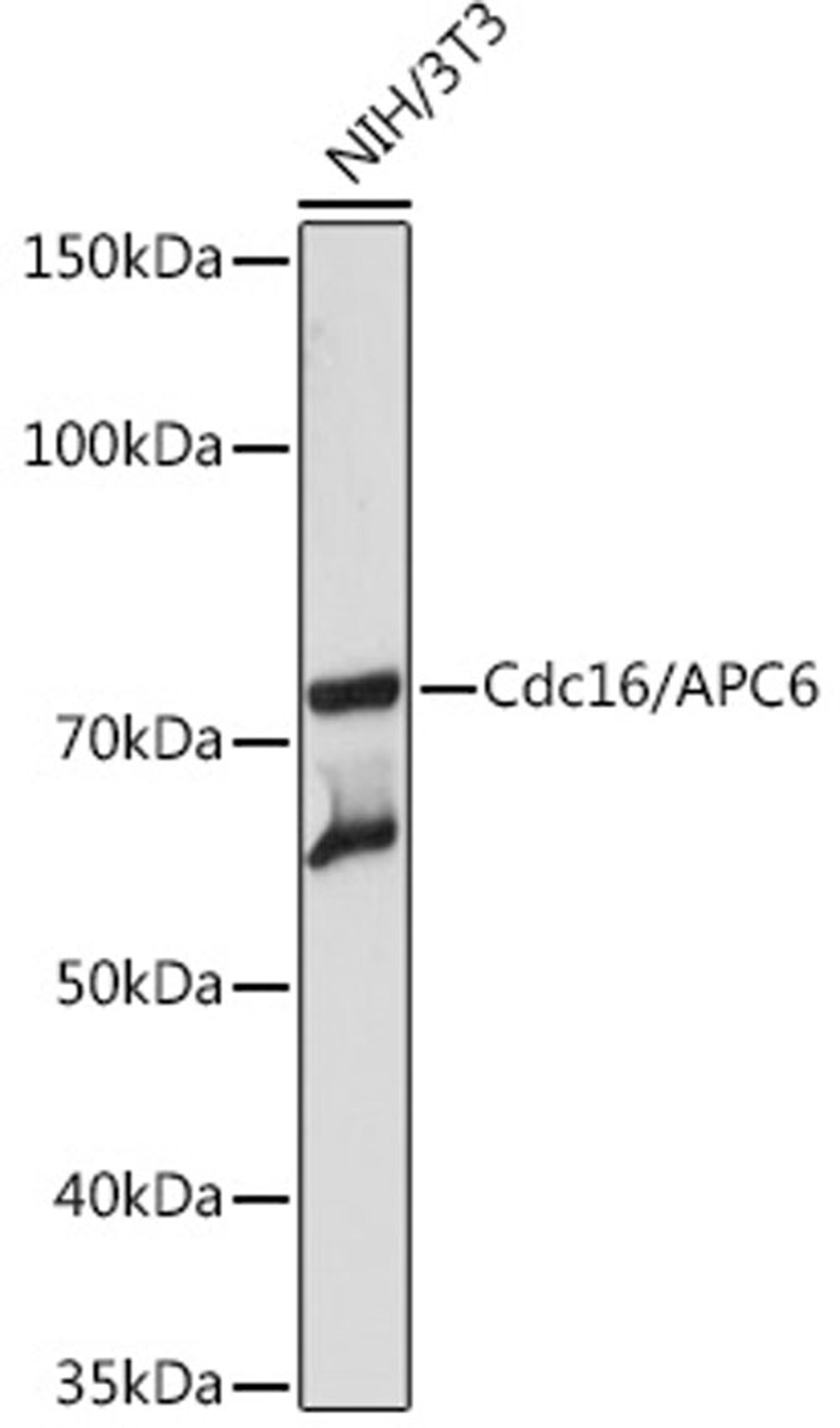 Western blot - Cdc16/APC6 Rabbit mAb (A3583)
