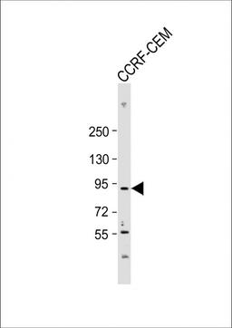 Western Blot at 1:2000 dilution + CCRF-CEM whole cell lysate Lysates/proteins at 20 ug per lane.