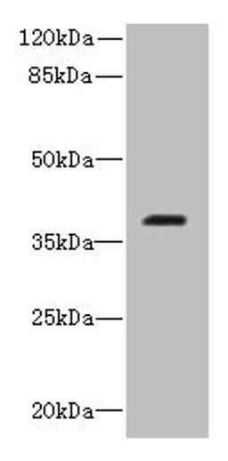 Western blot. All lanes: RIBC2 antibody at 0.8ug/ml + Caco-2 whole cell lysate. Secondary. Goat polyclonal to rabbit IgG at 1/10000 dilution. Predicted band size: 38 kDa. Observed band size: 38 kDa. 