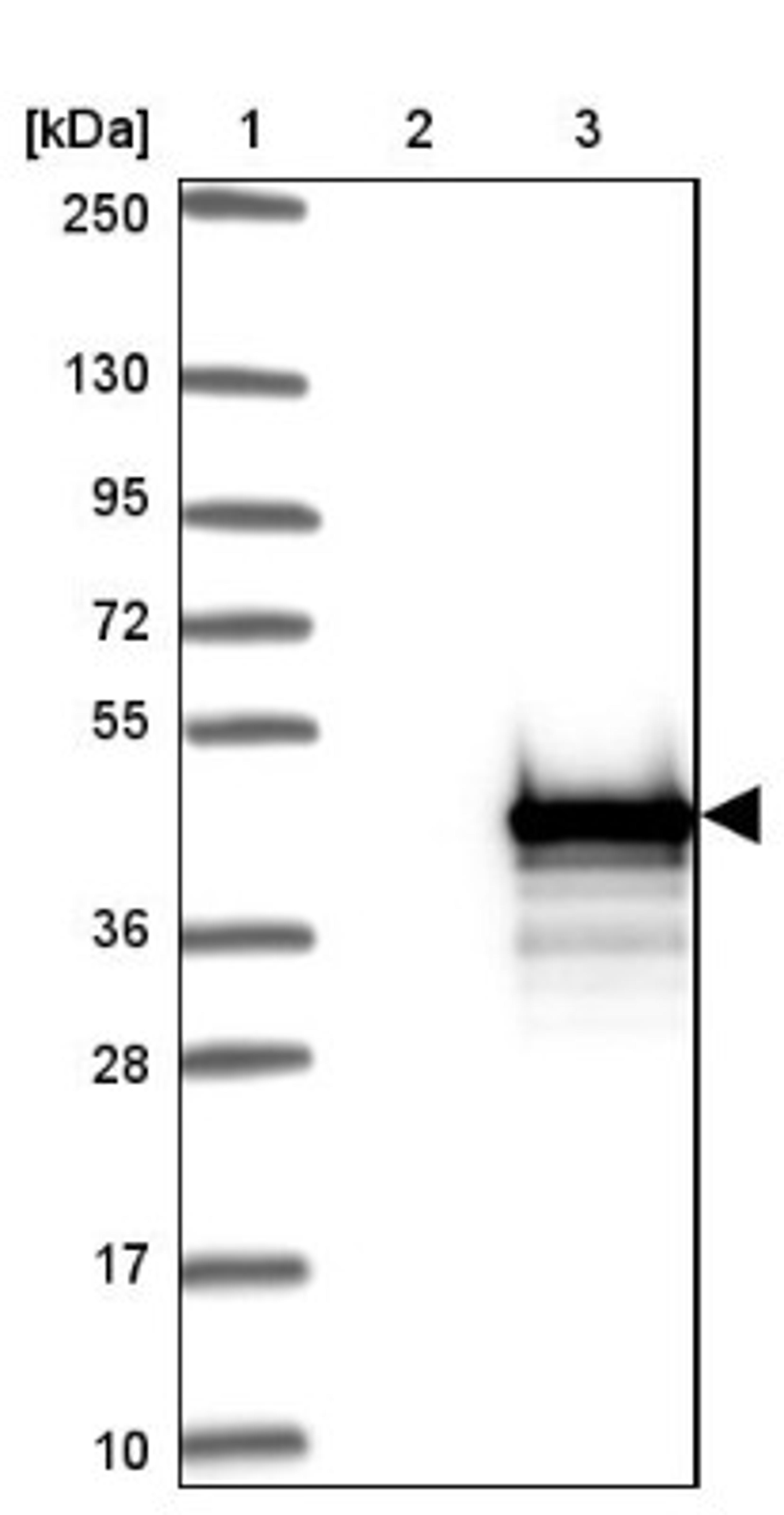 Western Blot: ZC3H12D Antibody [NBP1-91249] - Lane 1: Marker [kDa] 250, 130, 95, 72, 55, 36, 28, 17, 10<br/>Lane 2: Negative control (vector only transfected HEK293T lysate)<br/>Lane 3: Over-expression lysate (Co-expressed with a C-terminal myc-DDK tag (~3.1 kDa) in mammalian HEK293T cells, LY403981)