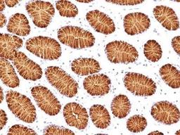 Immunohistochemistry-Paraffin: Mucin 5AC Antibody (45M1) [NBP2-15196] - Analysis using the Azide and BSA Free version of NBP2-15196. Detection Human stomach.