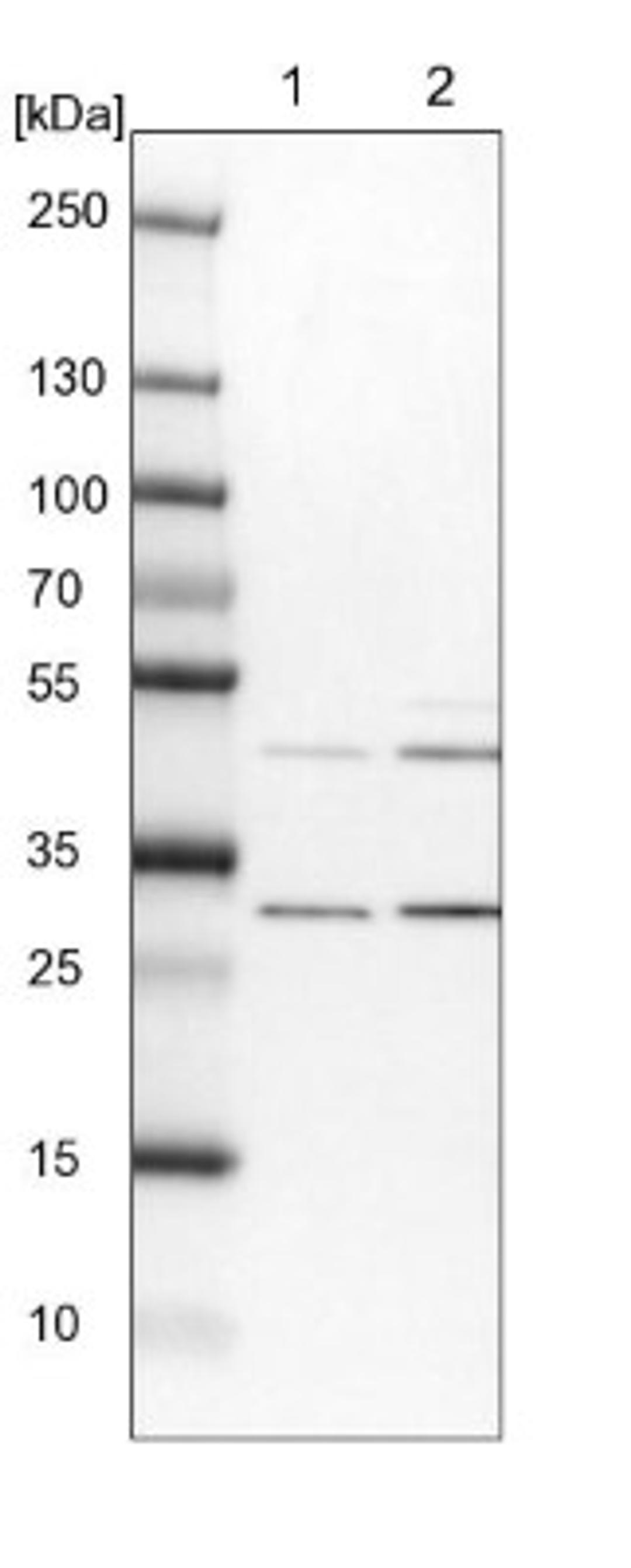 Western Blot: FAM53B Antibody [NBP1-88976] - Lane 1: NIH-3T3 cell lysate (Mouse embryonic fibroblast cells)<br/>Lane 2: NBT-II cell lysate (Rat Wistar bladder tumour cells)