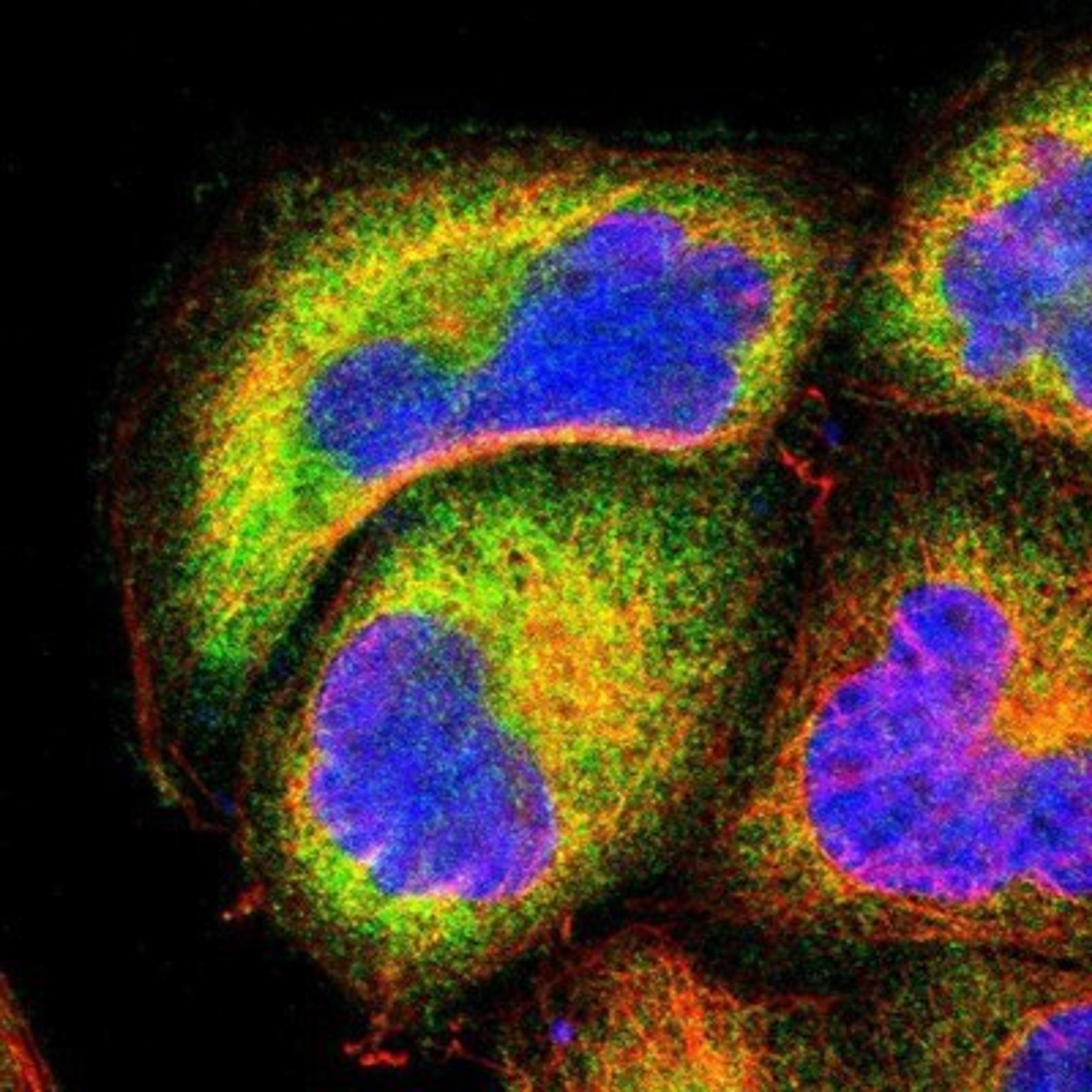 Immunocytochemistry/Immunofluorescence: NFkB p100/p52 Antibody [NBP1-87760] - Staining of human cell line A-431 shows positivity in cytoplasm.