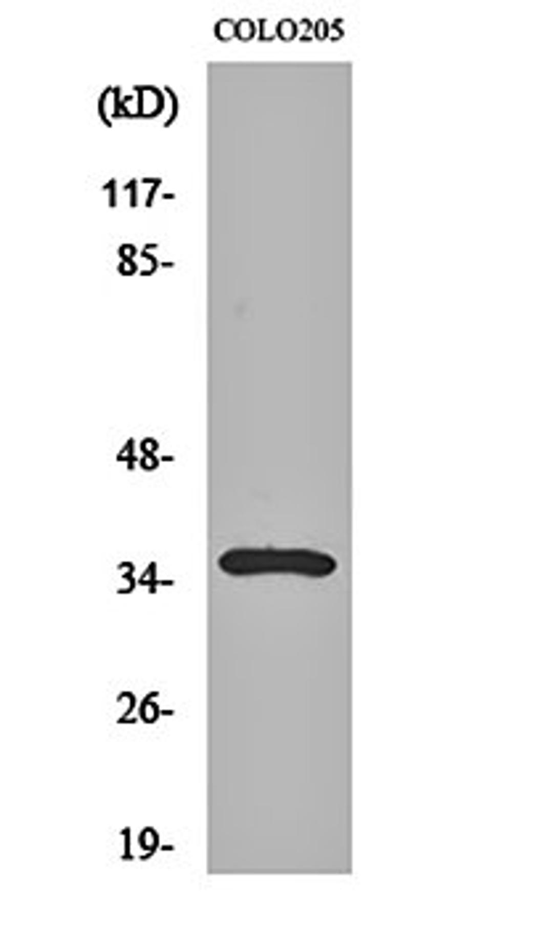 Western blot analysis of COLO205 cell lysates using Galectin-4 antibody