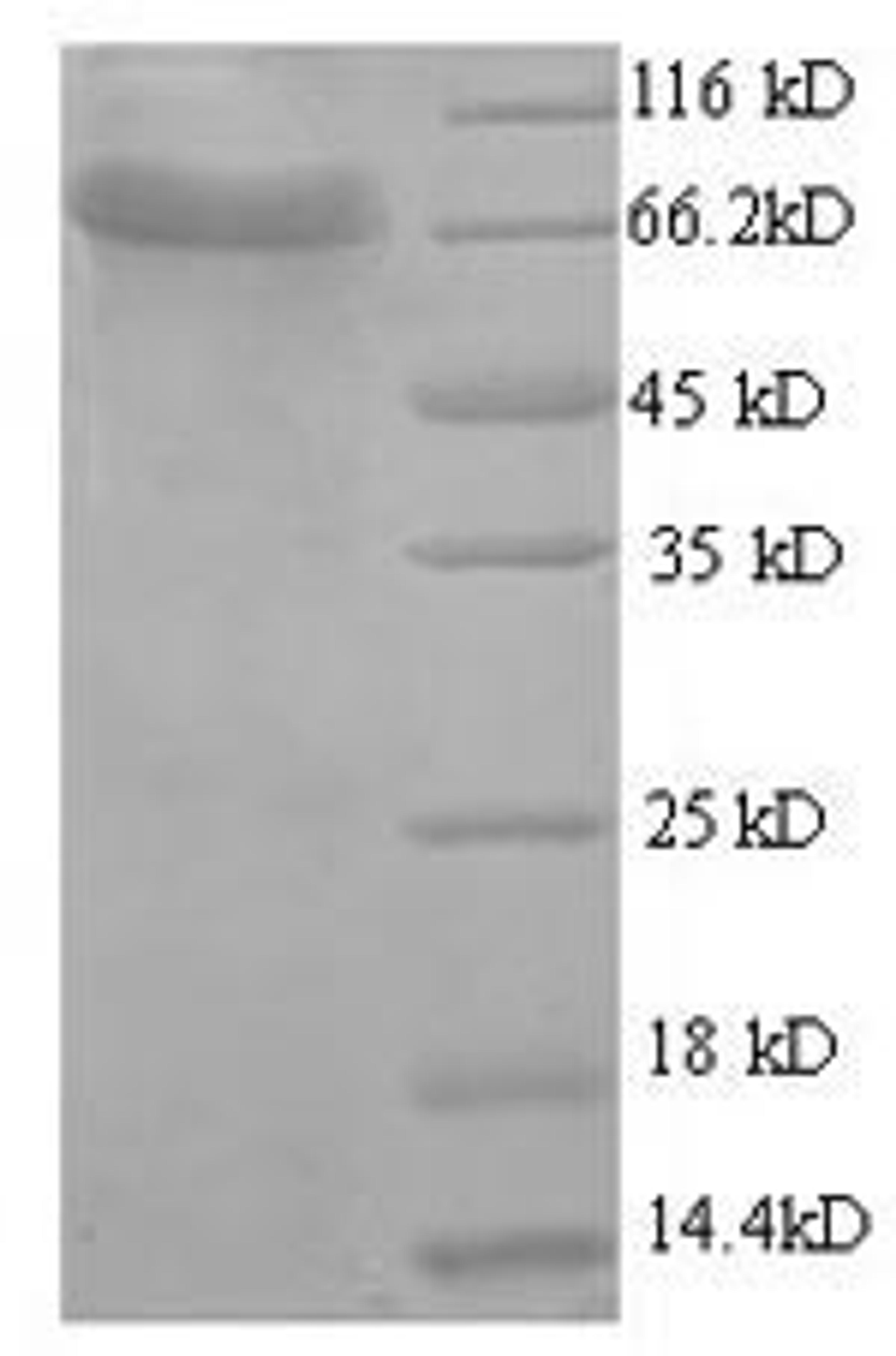 (Tris-Glycine gel) Discontinuous SDS-PAGE (reduced) with 5% enrichment gel and 15% separation gel.