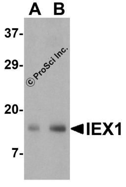 Western blot analysis of IEX-1 in mouse skin tissue lysate with IEX-1 antibody at (A) 1 and (B) 2 &#956;g/mL..