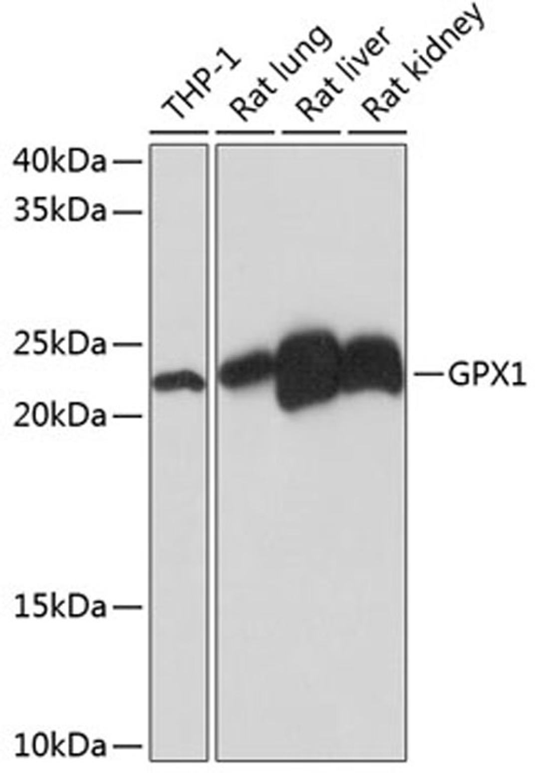 Western blot - GPX1 Rabbit mAb (A11166)