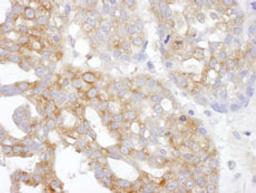 Detection of human IL14 by immunohistochemistry.