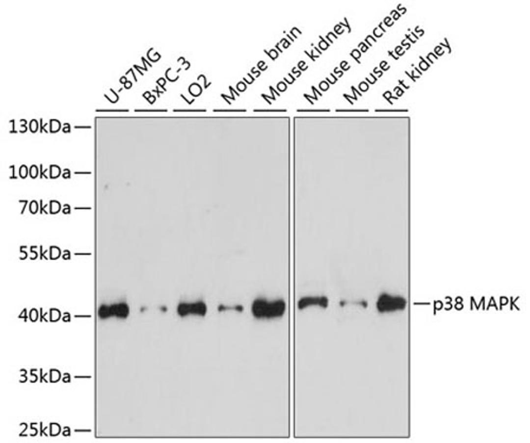 Western blot - p38 MAPK antibody (A14401)