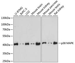 Western blot - p38 MAPK antibody (A14401)