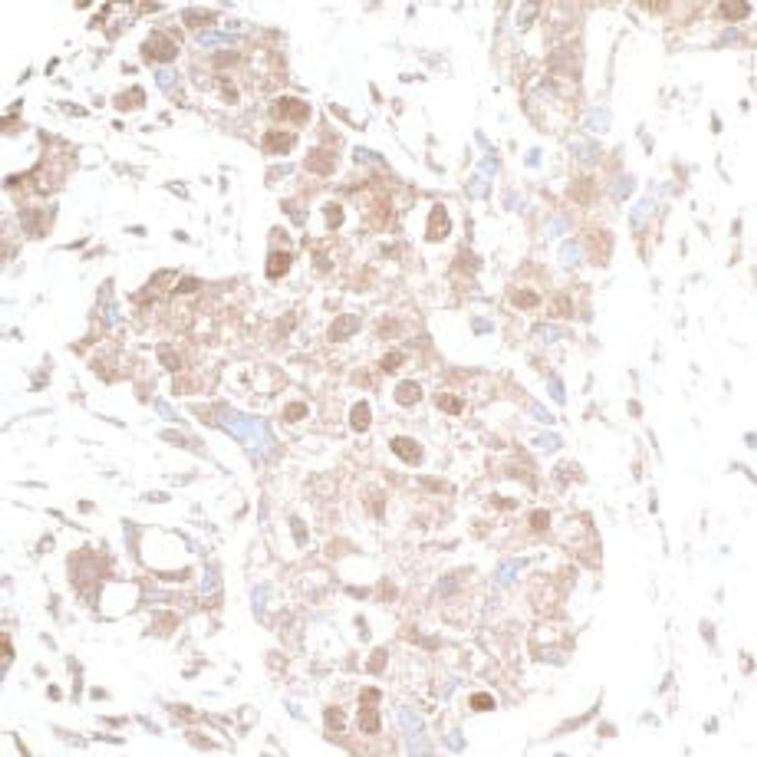 Detection of human p300 by immunohistochemistry.