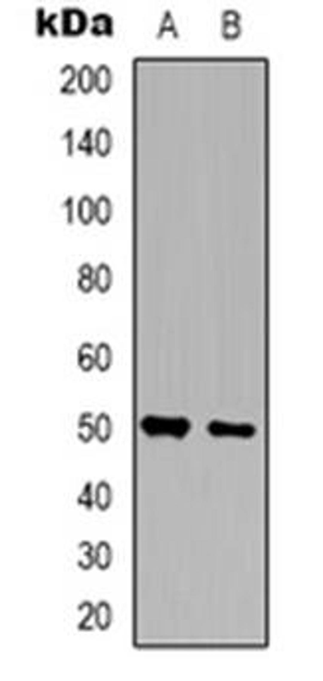 Western blot analysis of ZNF436 expression in HepG2 (Lane 1), U251 (Lane 2) whole cell lysates using ZNF436 antibody