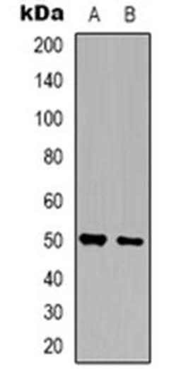 Western blot analysis of ZNF436 expression in HepG2 (Lane 1), U251 (Lane 2) whole cell lysates using ZNF436 antibody