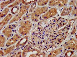 IHC image of CSB-PA613604LA01HU diluted at 1:500 and staining in paraffin-embedded human kidney tissue performed on a Leica BondTM system. After dewaxing and hydration, antigen retrieval was mediated by high pressure in a citrate buffer (pH 6.0). Section was blocked with 10% normal goat serum 30min at RT. Then primary antibody (1% BSA) was incubated at 4&deg;C overnight. The primary is detected by a biotinylated secondary antibody and visualized using an HRP conjugated SP system.