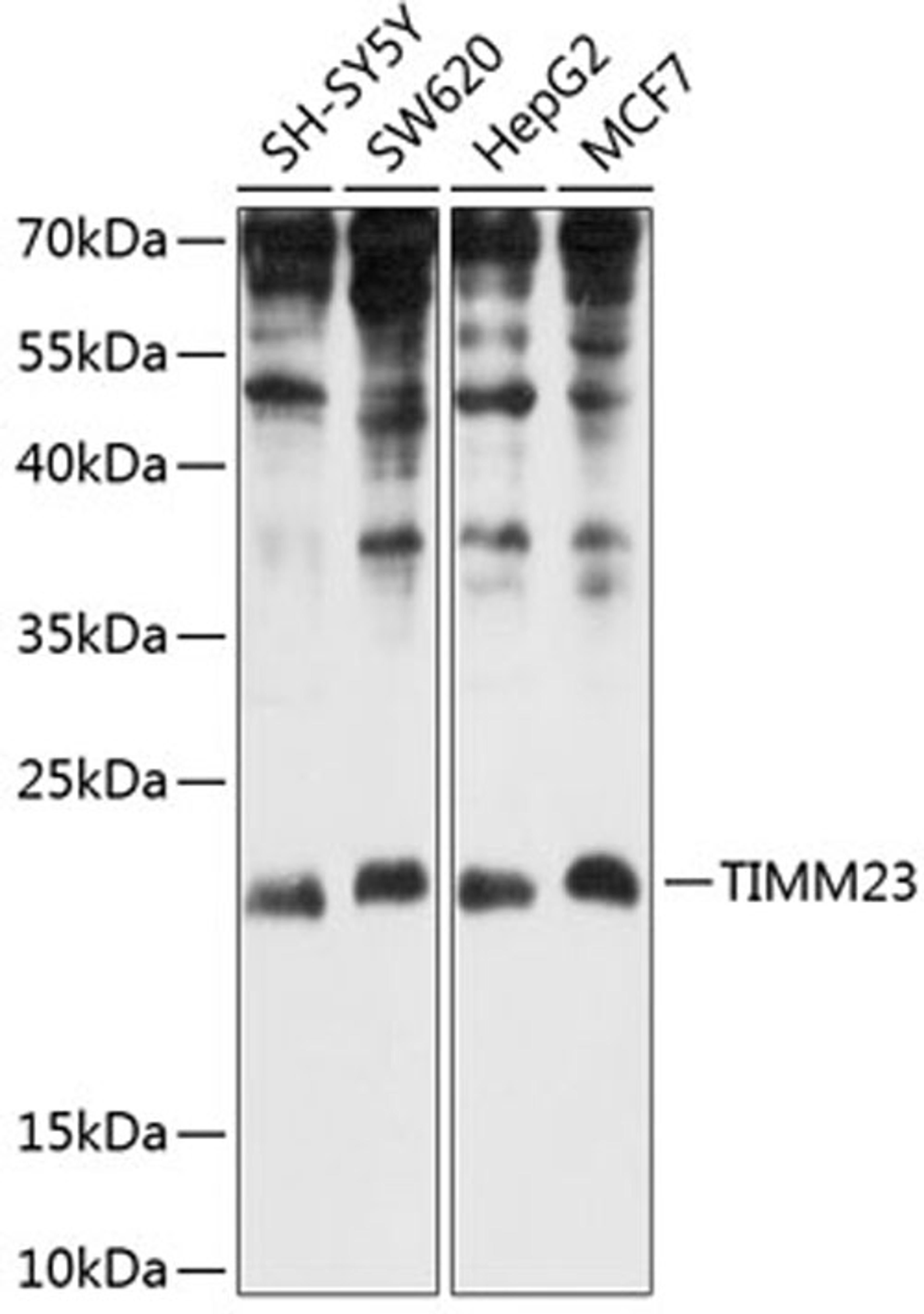 Western blot - TIMM23 antibody (A8688)