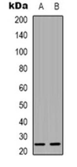 Western blot analysis of CMTM4 expression in Hela (Lane 1), A431 (Lane 2) whole cell lysates using CMTM4 antibody