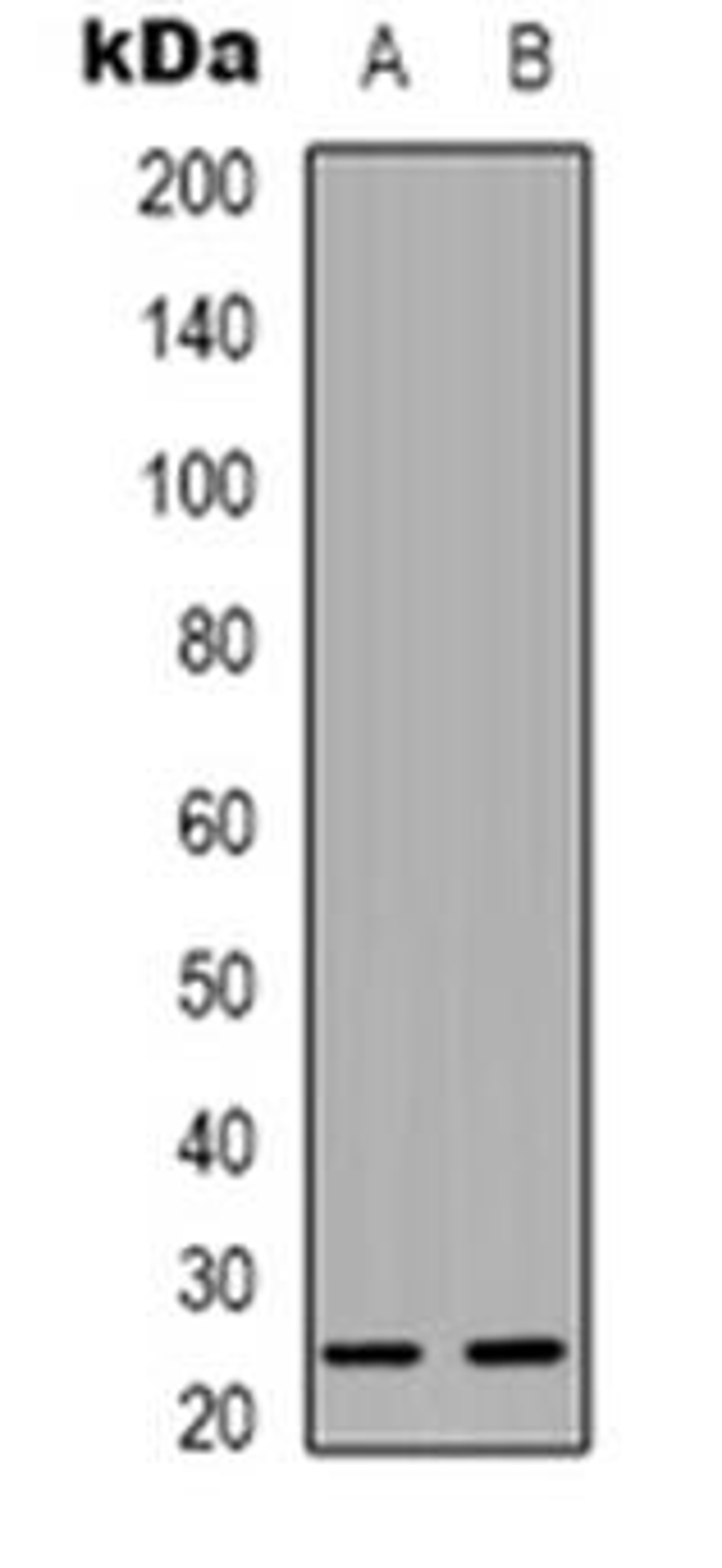 Western blot analysis of CMTM4 expression in Hela (Lane 1), A431 (Lane 2) whole cell lysates using CMTM4 antibody