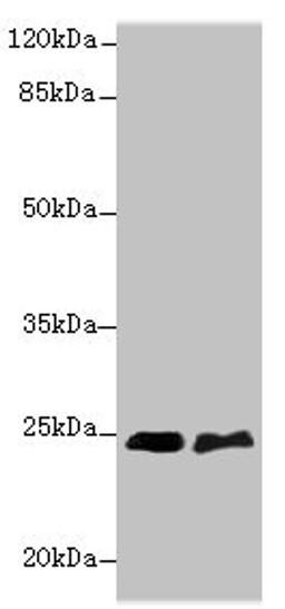 Western blot. All lanes: SERTAD1 antibody at 6ug/ml. Lane 1: SH-SY5Y whole cell lysate. Lane 2: A549 whole cell lysate. Secondary. Goat polyclonal to rabbit IgG at 1/10000 dilution. Predicted band size: 25 kDa. Observed band size: 25 kDa. 