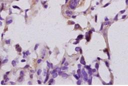 Paraffin-embedded mouse lung tissue fixed with 4% paraformaldehyde. Antigen retrieval by boiling with citrate buffer. Blocking buffer is goat serum (37 degrees for 20 min.). LTB4-R1 antibody at 1:200 dilution with overnight incubation at 4 degrees 