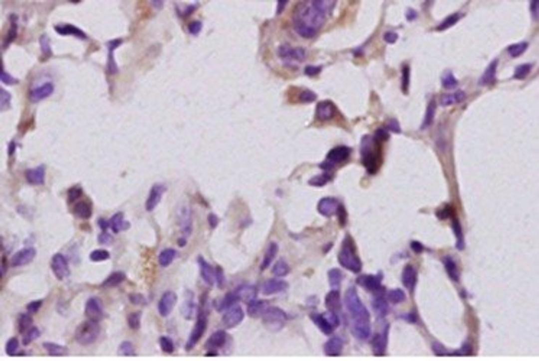 Paraffin-embedded mouse lung tissue fixed with 4% paraformaldehyde. Antigen retrieval by boiling with citrate buffer. Blocking buffer is goat serum (37 degrees for 20 min.). LTB4-R1 antibody at 1:200 dilution with overnight incubation at 4 degrees