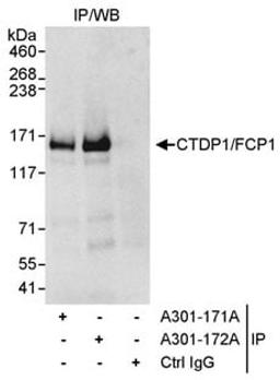 Detection of human CTDP1/FCP1 by western blot of immunoprecipitates.