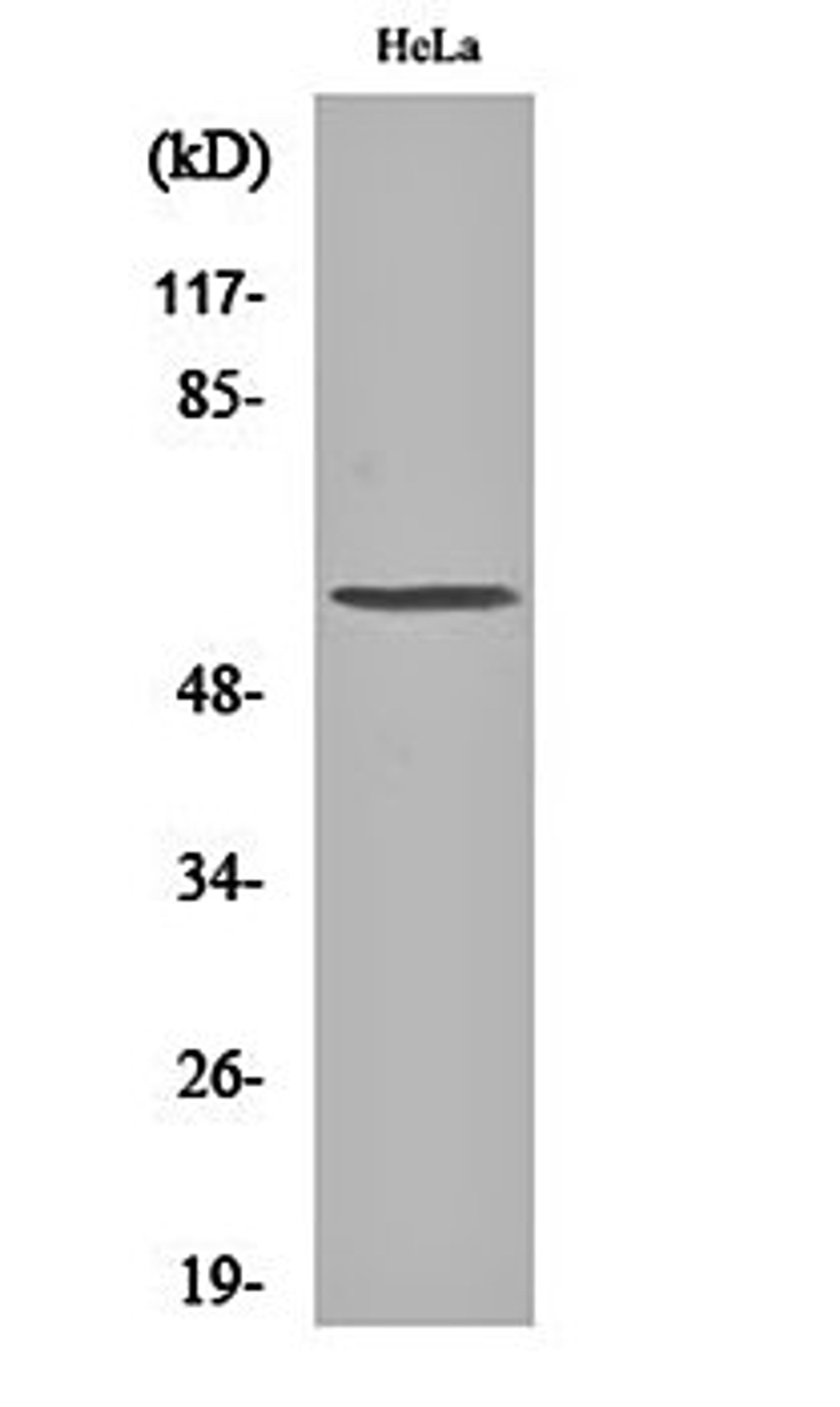 Western blot analysis of Hela cell lysates using PLK-5 antibody