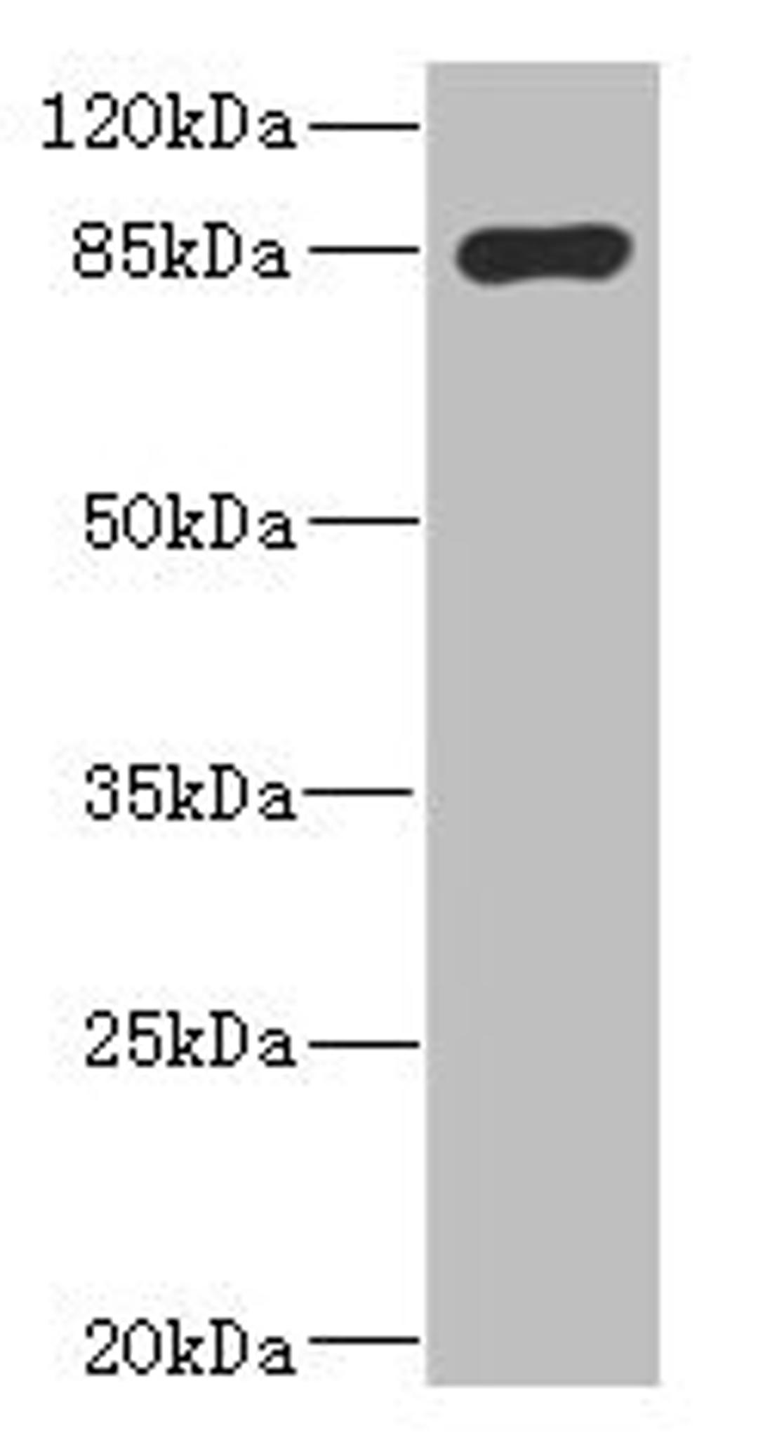 Western blot. All lanes: MARK1 antibody IgG at 2.65ug/ml + Rat heart tissue. Secondary. Goat polyclonal to rabbit IgG at 1/10000 dilution. Predicted band size: 90, 73, 85 kDa. Observed band size: 90 kDa.