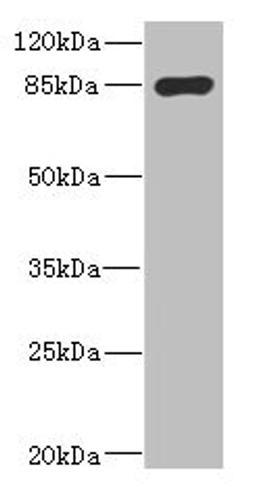 Western blot. All lanes: MARK1 antibody IgG at 2.65ug/ml + Rat heart tissue. Secondary. Goat polyclonal to rabbit IgG at 1/10000 dilution. Predicted band size: 90, 73, 85 kDa. Observed band size: 90 kDa.