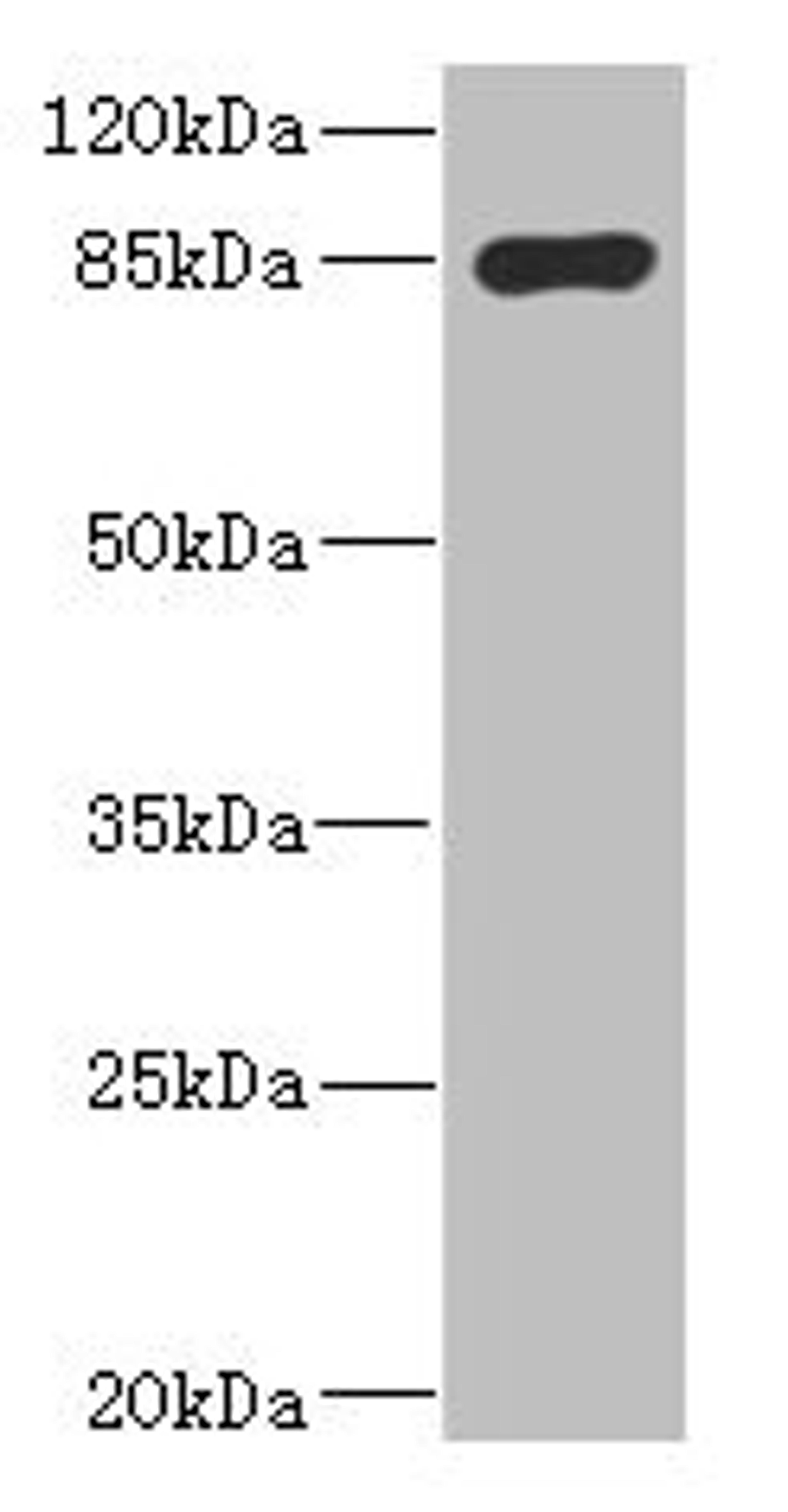 Western blot. All lanes: MARK1 antibody IgG at 2.65ug/ml + Rat heart tissue. Secondary. Goat polyclonal to rabbit IgG at 1/10000 dilution. Predicted band size: 90, 73, 85 kDa. Observed band size: 90 kDa.