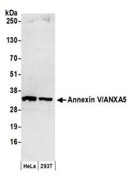 Detection of human Annexin V/ANXA5 by western blot.