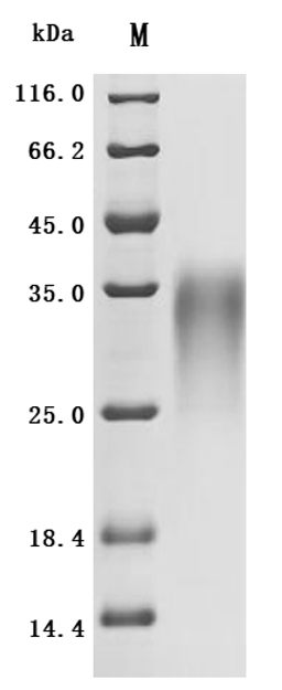 (Tris-Glycine gel) Discontinuous SDS-PAGE (reduced) with 5% enrichment gel and 15% separation gel.