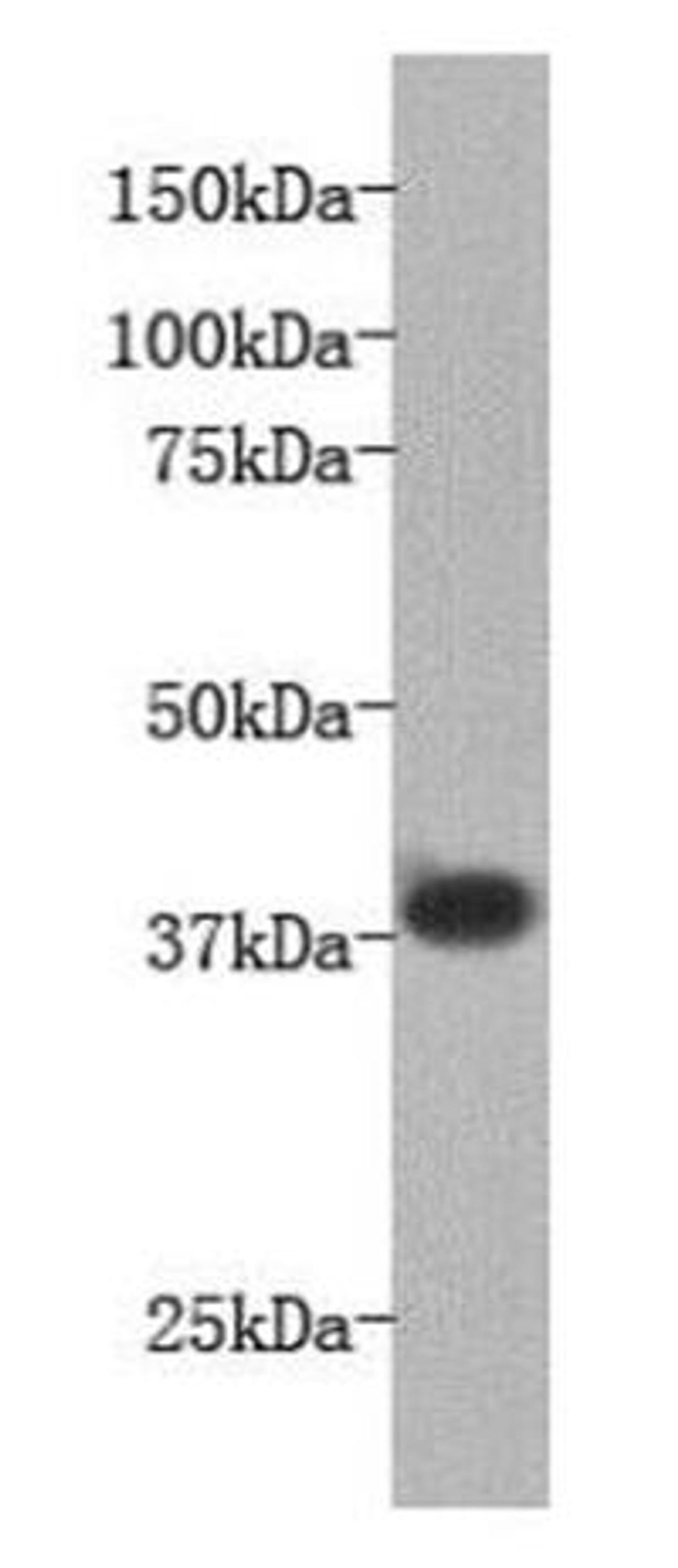 Western blot analysis of mouse liver Dirty tissue using LPA receptor 1 antibody