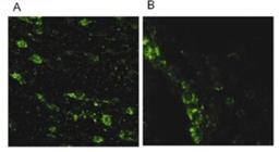 Immunocytochemistry/Immunofluorescence: LRRK2 Antibody [NB110-58771] - Immunofluorescence of Lrrk2 with NB110-58771 within (A) Substantia nigra neurons (B) Chains of migrating neuroblasts.