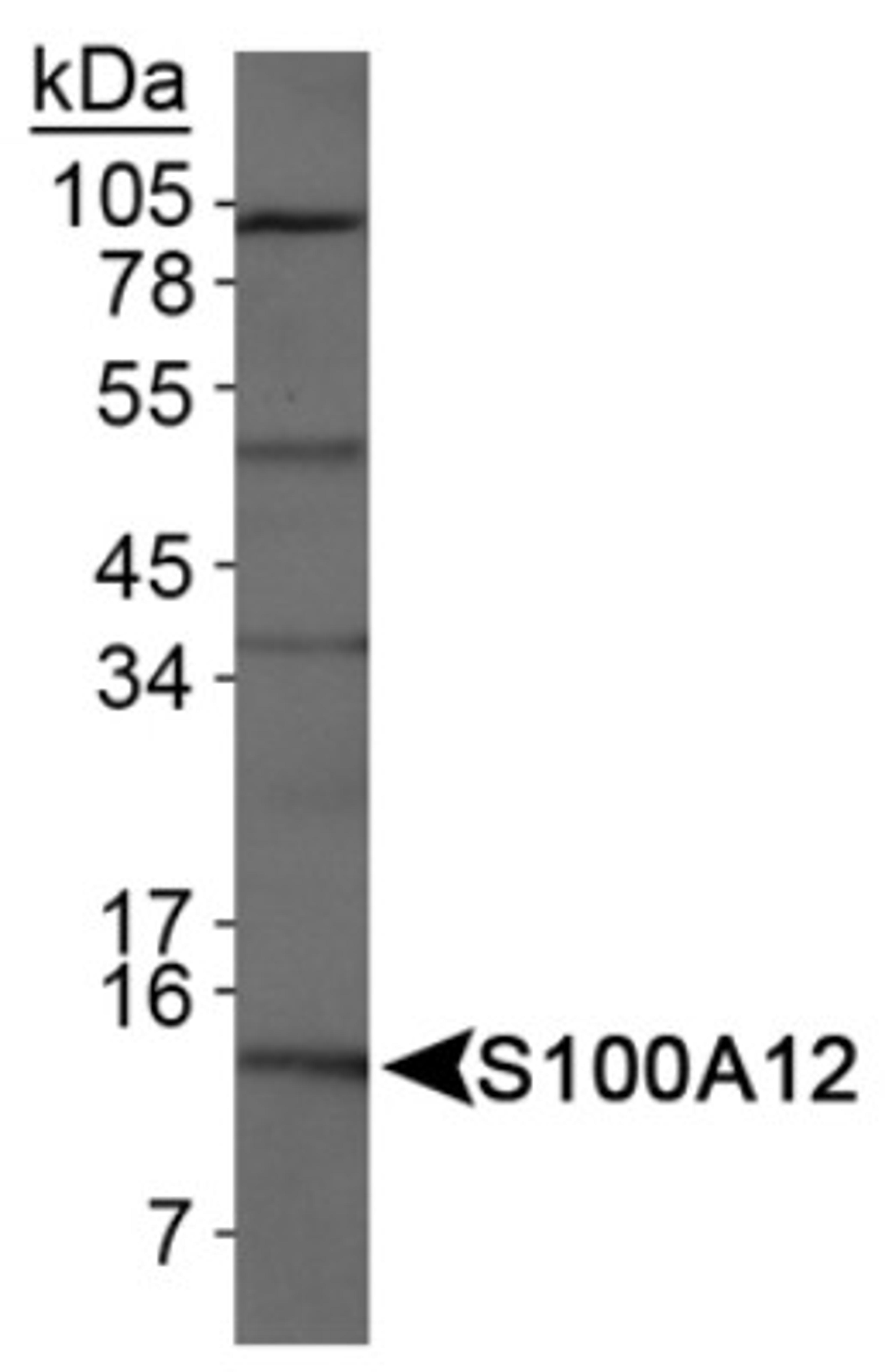 Western Blot: S100A12 Antibody [NB110-90136] - Detection of S100A12 in HeLa whole cell extracts.