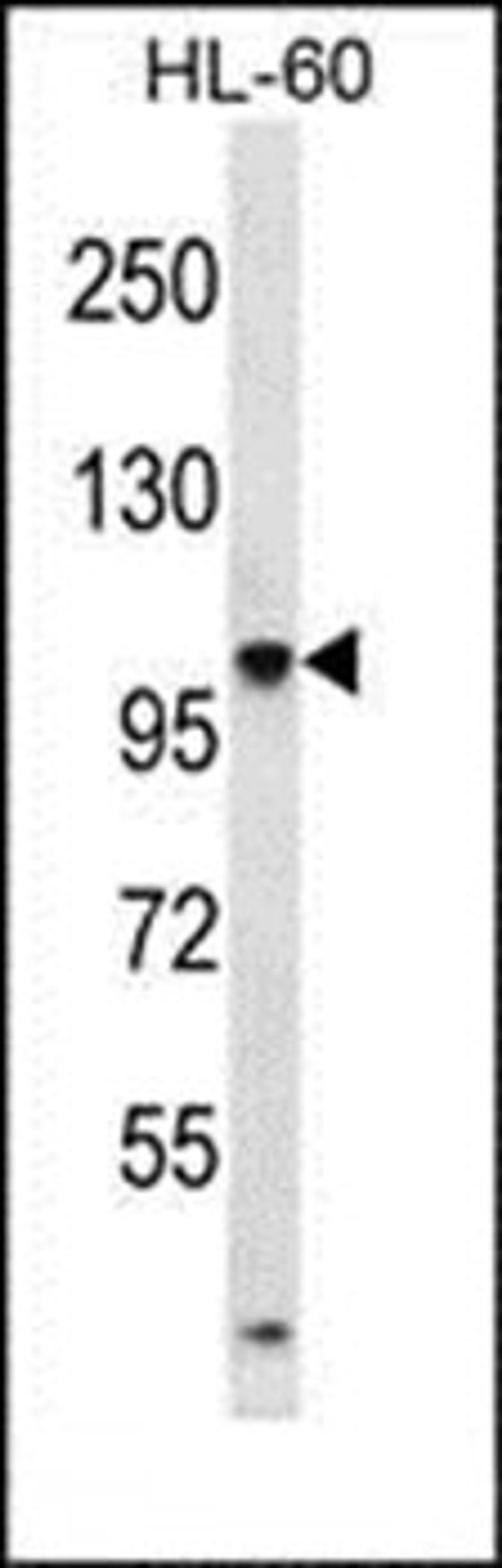 Western blot analysis of HL-60 cell line lysates (35ug/lane) using TTLL4 antibody (Center)