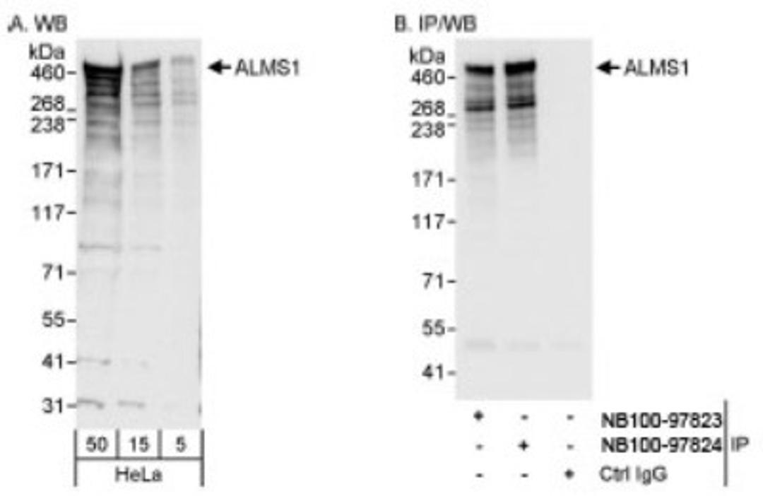 Western Blot: ALMS1 Antibody [NB100-97823] - Whole cell lysate (5, 15 and 50 mcg for WB; 1 mg for IP, 20% of IP loaded) from HeLa cells.  NB100-97823 used for WB at 0.04 mcg/ml (A) and 0.1 mcg/ml (B) and used for IP at 3 mcg/mg lysate.  ALMS1 was also immunoprecipitated by NB100-97824, which recognizes a downstream epitope.