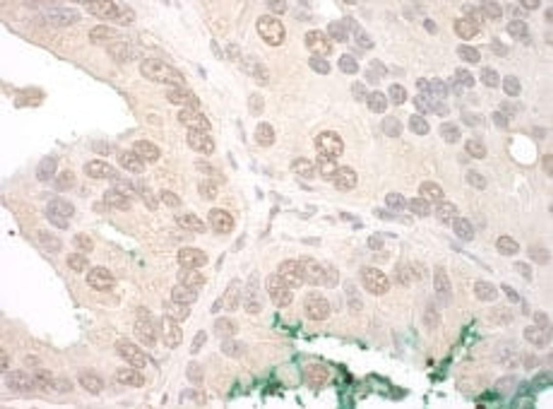 Detection of human ORC2 by immunohistochemistry.