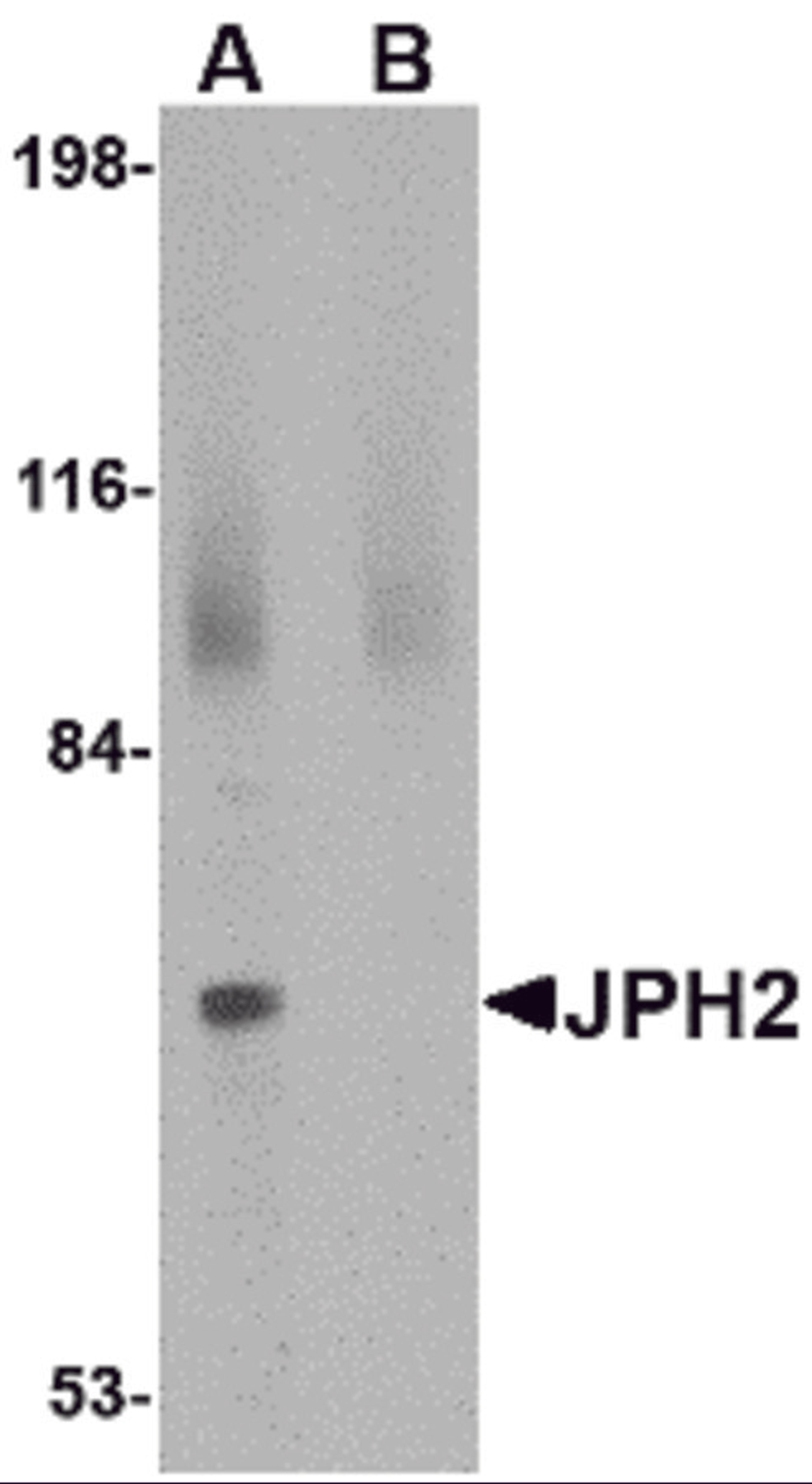 Western blot analysis of JPH2 in 293 cell lysate with JPH2 antibody at 2 &#956;g/mL in (A) the absence and (B) the presence of blocking peptide.