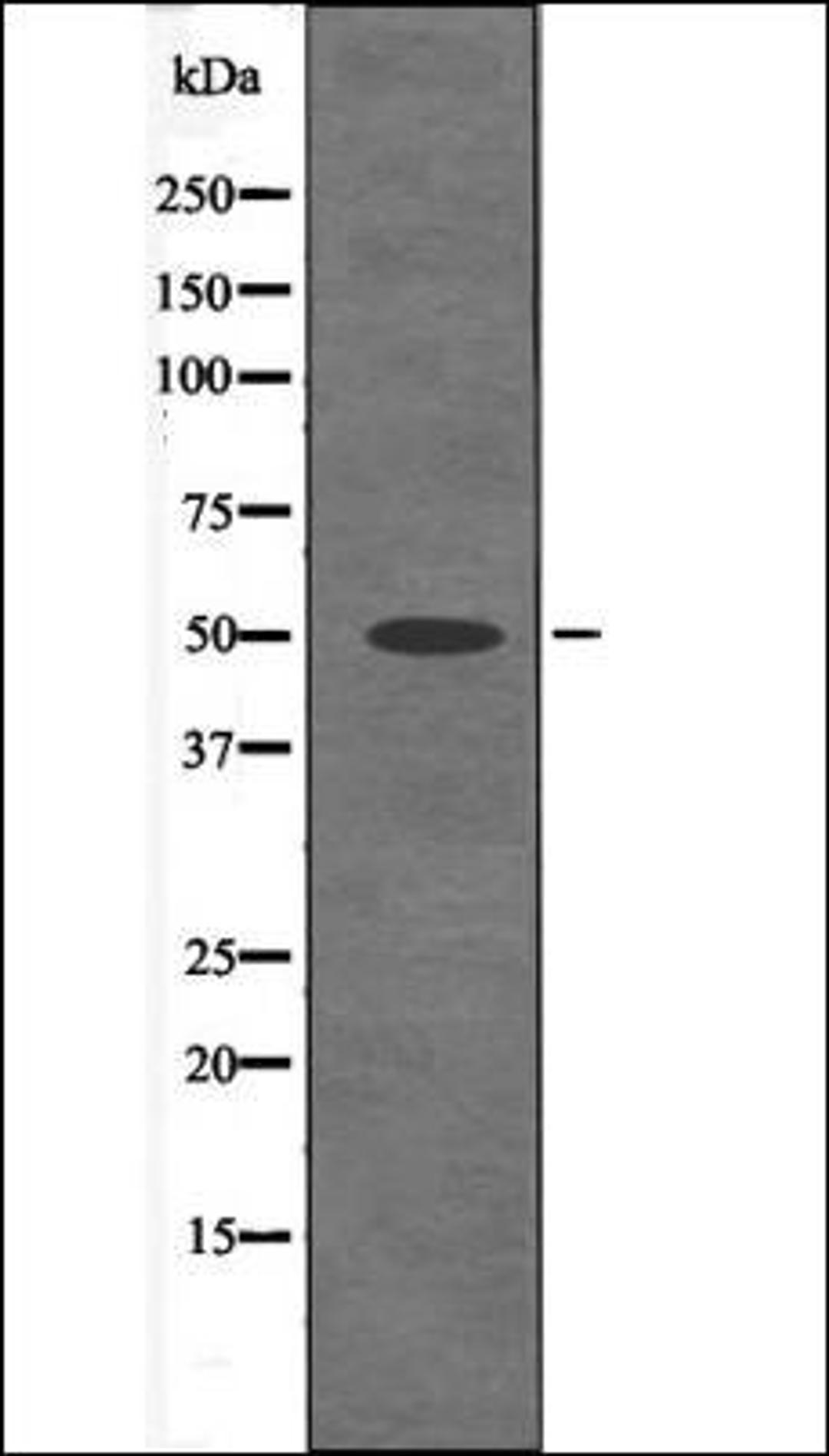 Western blot analysis of Mouse braintissue lysates using MST3 -Phospho-Thr18- antibody