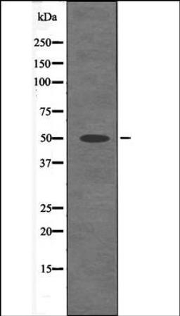 Western blot analysis of Mouse braintissue lysates using MST3 -Phospho-Thr18- antibody