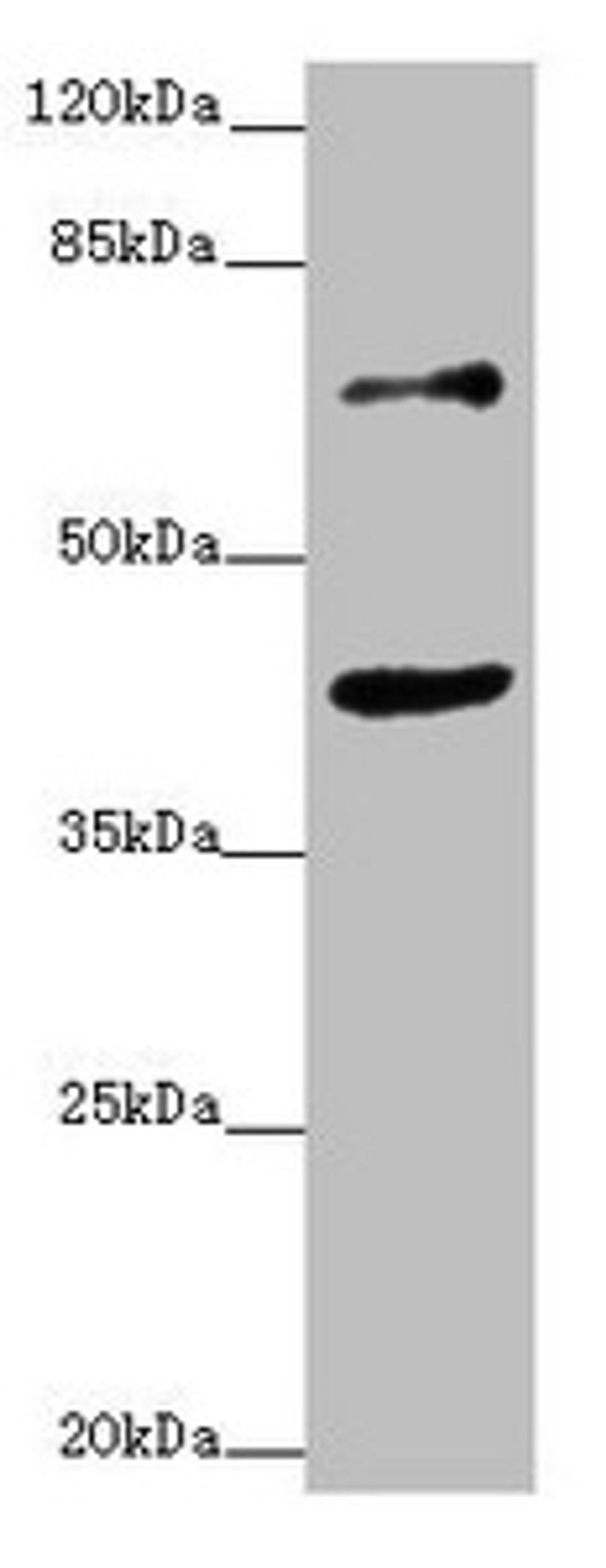 Western blot. All lanes: ZNF20 antibody at 2.53ug/ml + MCF-7 whole cell lysate. Secondary. Goat polyclonal to rabbit IgG at 1/10000 dilution. Predicted band size: 62 kDa. Observed band size: 62, 40 kDa. 