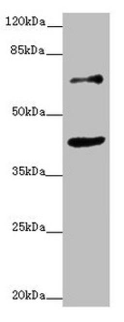 Western blot. All lanes: ZNF20 antibody at 2.53ug/ml + MCF-7 whole cell lysate. Secondary. Goat polyclonal to rabbit IgG at 1/10000 dilution. Predicted band size: 62 kDa. Observed band size: 62, 40 kDa. 